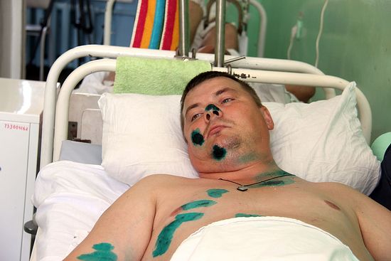  Александр Косолапов