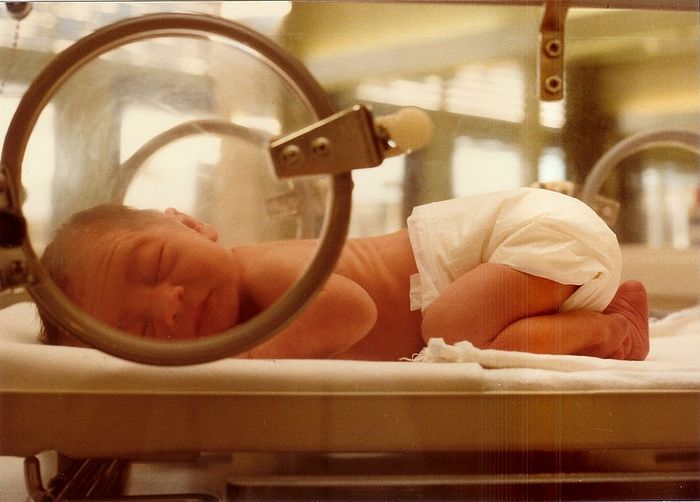 Выхаживание недоношенного ребенка в специальном кувезе